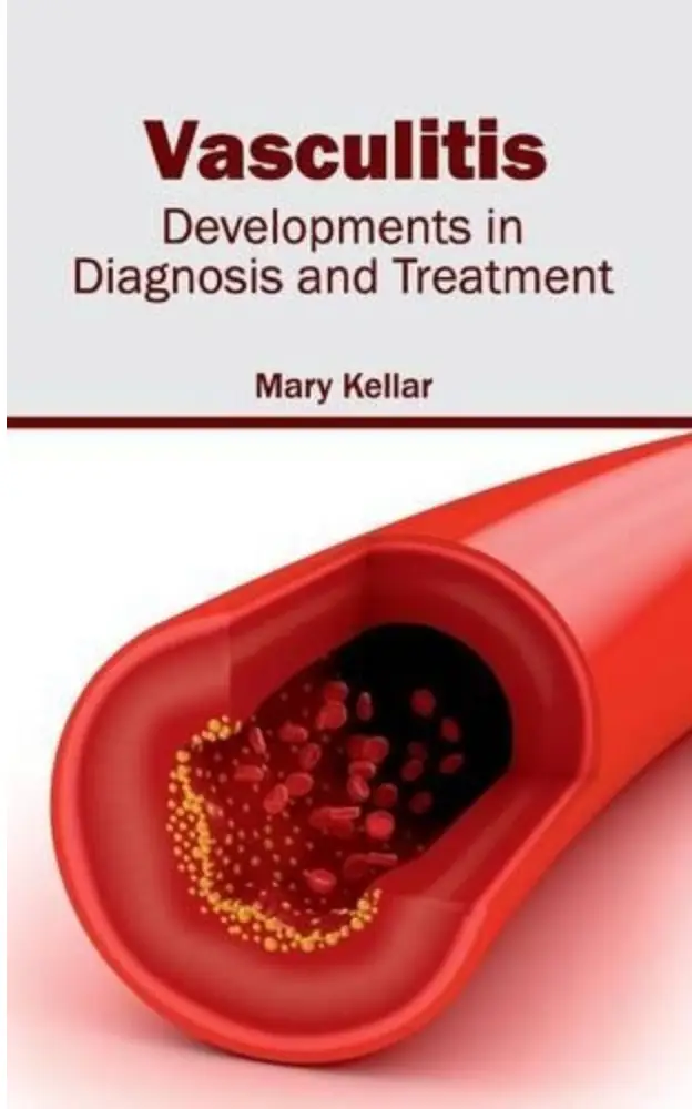 Vasculitis: Developments in Diagnosis and Treatment 1st Ed