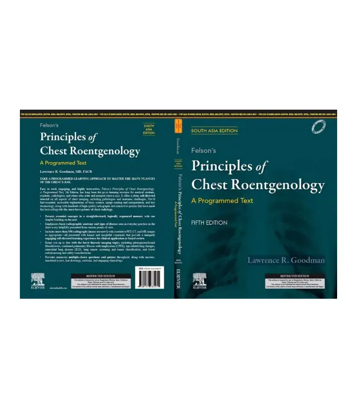 Felsons Principles of Chest Roentgenology A Programmed Text 5 th saeRoentgenology A Programmed Text 5 SAE