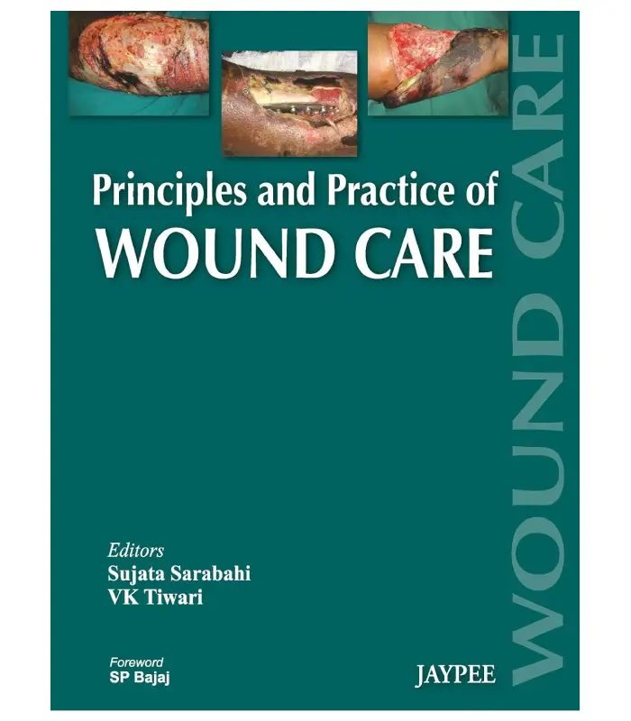 Principles and Practice of Wound Care 1 Ed