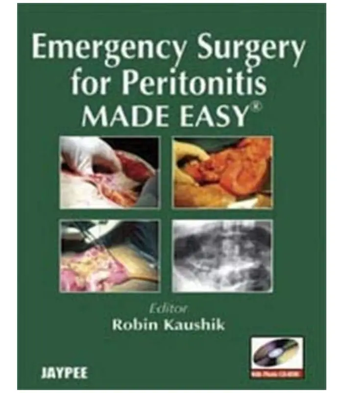 Emergency Surgery for Peritonitis Made Easy 1Ed